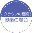 �N���E���̎�ށi�����̏ꍇ�j