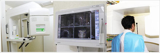 クローバー歯科クリニック豊中本町院 歯科用CT