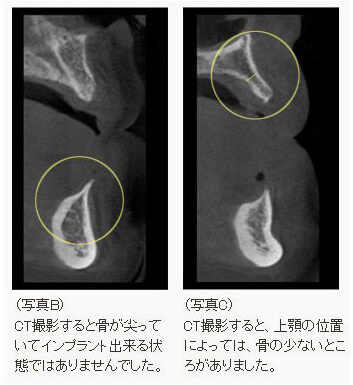 CTBe摜