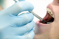 虫歯や歯周病のチェック