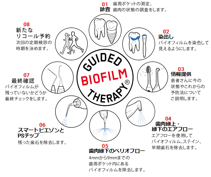 GBT(Guided Biofilm Therapy)プロトコールの８つのステップ