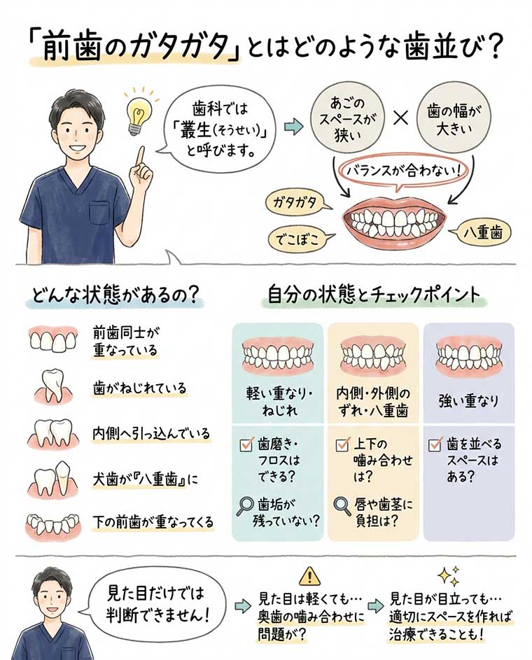 前歯のガタガタとはどのような歯並び？の図解