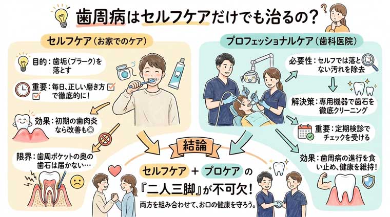 歯周病はセルフケアだけでも治るの？の図解