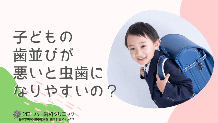 子どもの歯並びが悪いと虫歯になりやすいの？