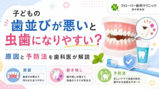 子どもの歯並びが悪いと虫歯になりやすい？原因と予防法を歯科医が解説