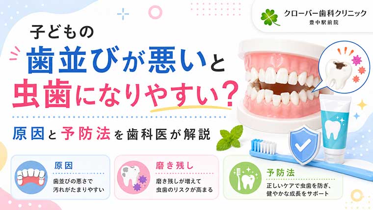 子どもの歯並びが悪いと虫歯になりやすい？原因と予防法を歯科医が解説