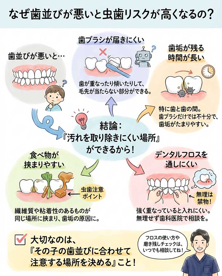 なぜ歯並びが悪いと虫歯リスクが高くなるの？の図解