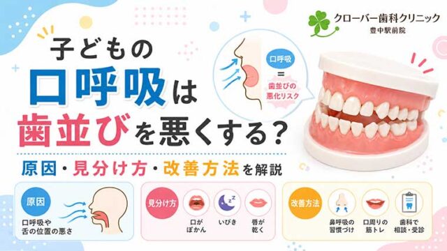 子どもの口呼吸は歯並びを悪くする？原因・見分け方・改善方法を解説