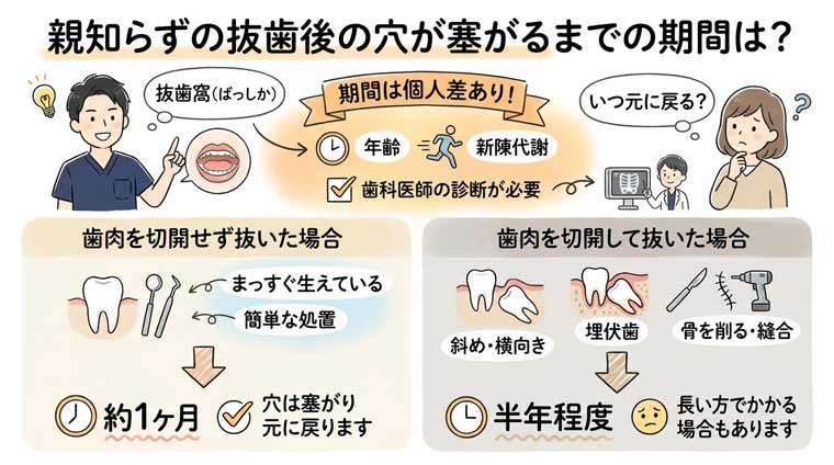 親知らずの抜歯後の穴が塞がるまでの期間は？の図解