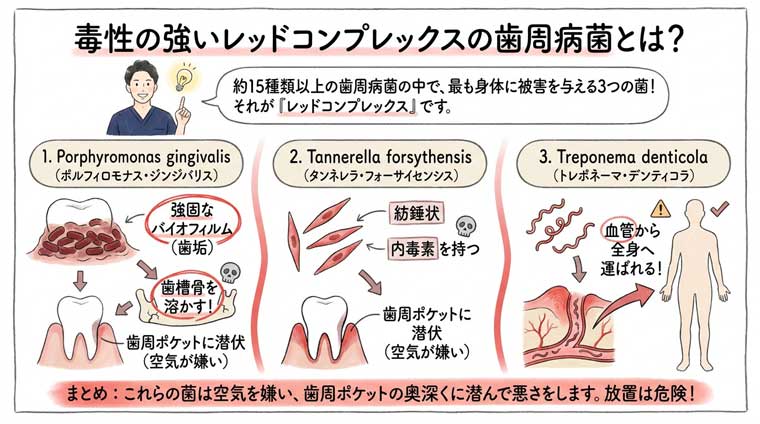 毒性の強いレッドコンプレックスの歯周病菌とは？の図解