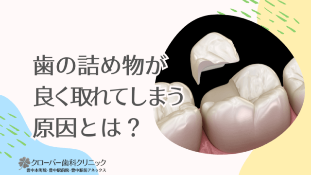 歯の詰め物が良く取れてしまう原因とは？