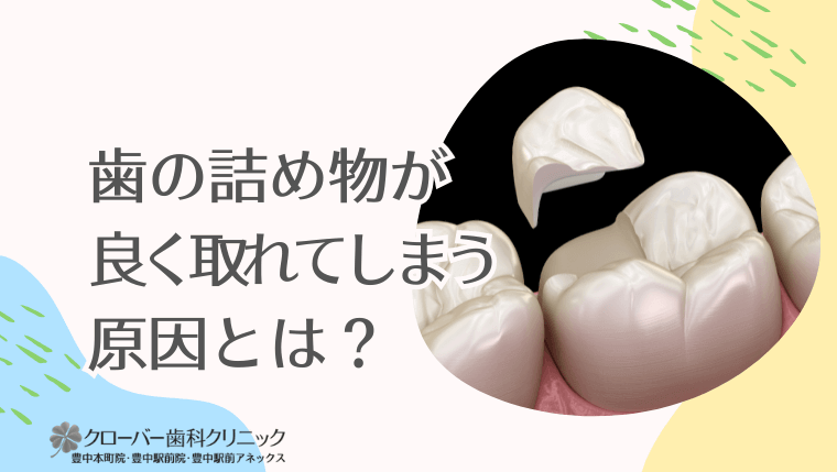 歯の詰め物が良く取れてしまう原因とは？