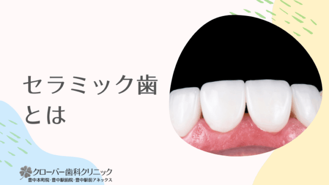 セラミック歯とは