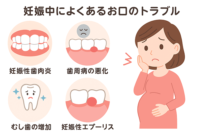 妊娠中によくあるお口のトラブル