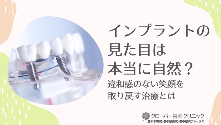 インプラントの見た目は本当に自然?