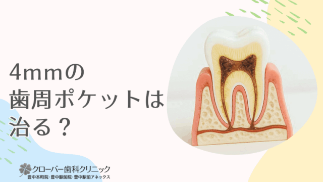 4mmの歯周ポケットは治る？