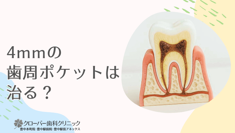 4mmの歯周ポケットは治る?