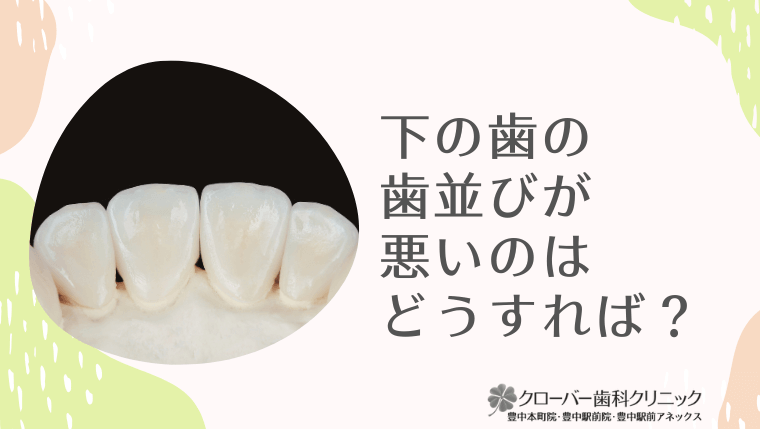 下の歯の歯並びが悪いのはどうすれば?