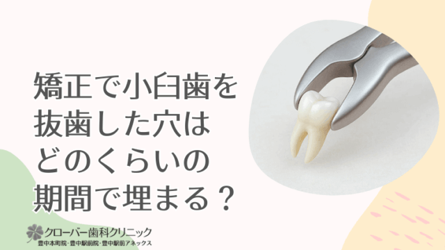 矯正で小臼歯を抜歯した穴はどのくらいの期間で埋まる？
