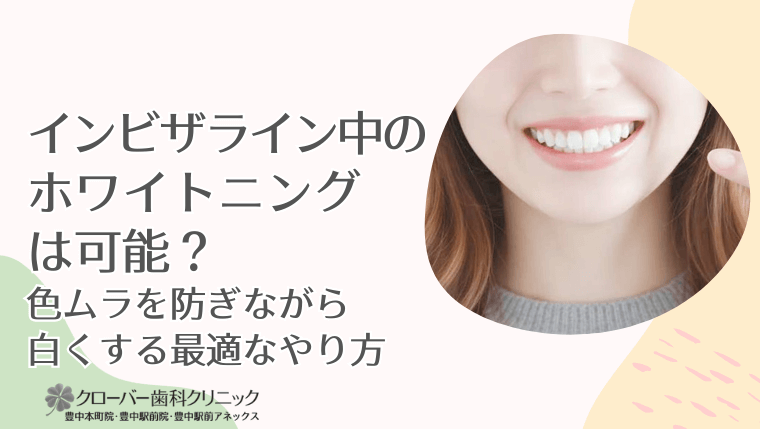 インビザライン中のホワイトニングは可能？色ムラを防ぎながら白くする最適なやり方