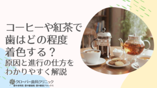 コーヒーや紅茶で歯はどの程度着色する？原因と進行の仕方をわかりやすく解説