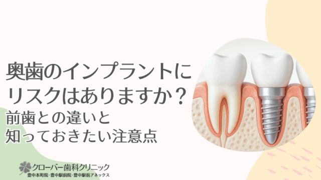 奥歯のインプラントにリスクはありますか？前歯との違いと知っておきたい注意点