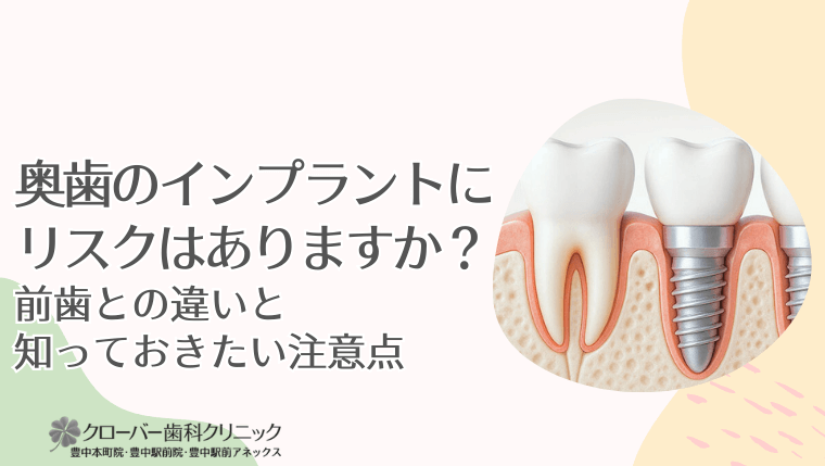 奥歯のインプラントにリスクはありますか？前歯との違いと知っておきたい注意点