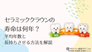 セラミッククラウンの寿命は何年？平均年数と長持ちさせる方法を解説