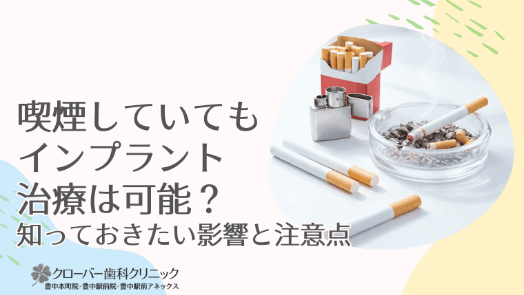 喫煙していてもインプラント治療は可能？知っておきたい影響と注意点