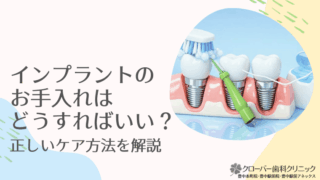 インプラントのお手入れはどうすればいい？正しいケア方法を解説
