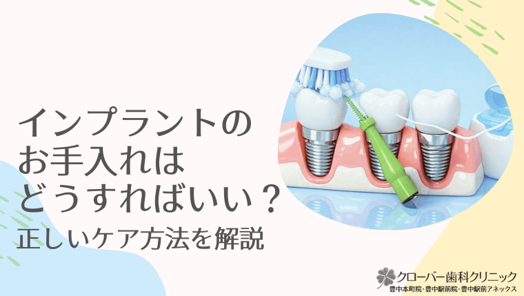 インプラントのお手入れはどうすればいい？正しいケア方法を解説