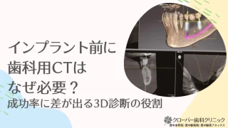 インプラント前に歯科用CTはなぜ必要？成功率に差が出る3D診断の役割