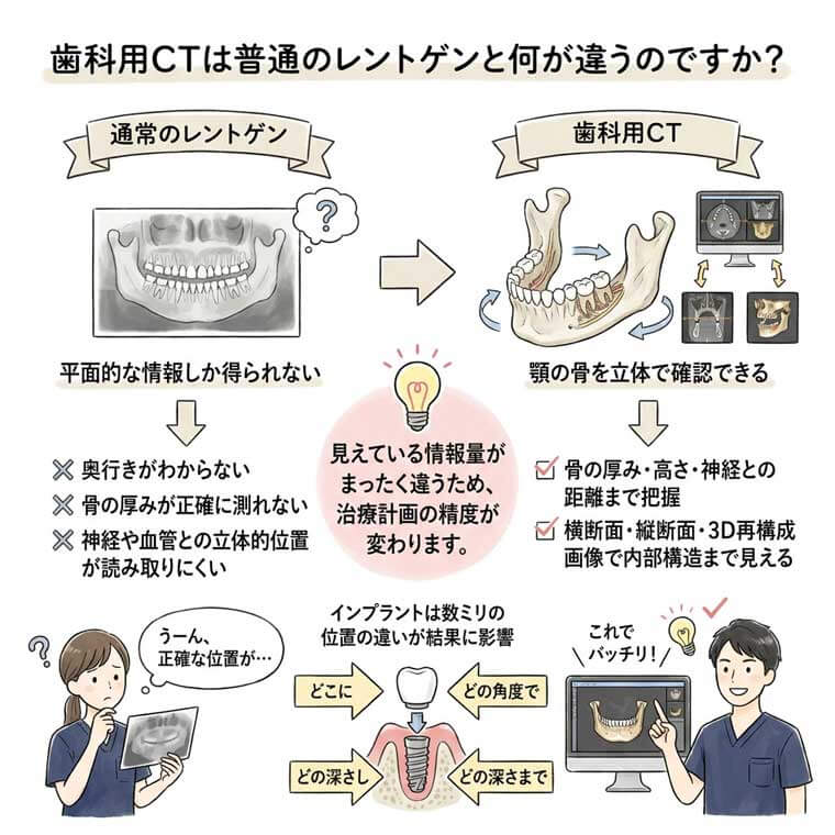 歯科用CTと普通のレントゲンとでは何が違うのですか？の図解
