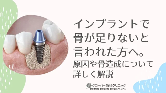 インプラントで骨が足りないと言われた方へ。原因や骨造成について詳しく解説