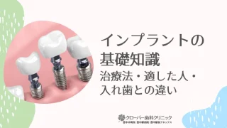 インプラントの基礎知識｜治療法・適した人・入れ歯との違い