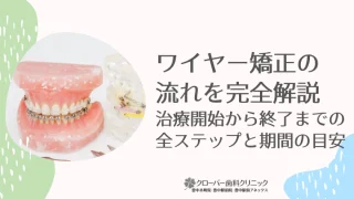 ワイヤー矯正の流れを完全解説！治療開始から終了までの全ステップ