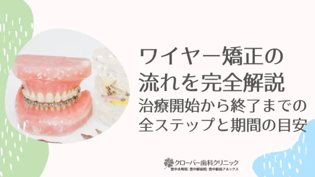 ワイヤー矯正の流れを完全解説！治療開始から終了までの全ステップ