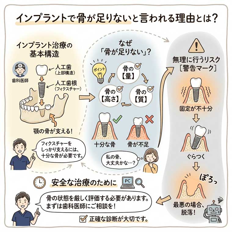 インプラントで骨が足りないと言われる理由とは？の図解