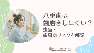 八重歯は歯磨きしにくい？虫歯・歯周病リスクを解説