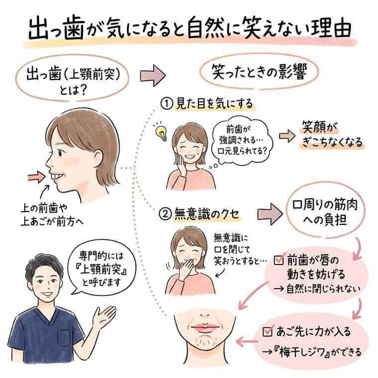 出っ歯が気になると自然に笑えない理由の図解