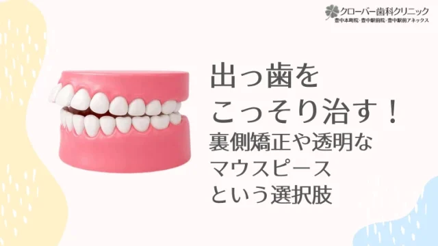 出っ歯をこっそり治す！裏側矯正や透明なマウスピースという選択肢