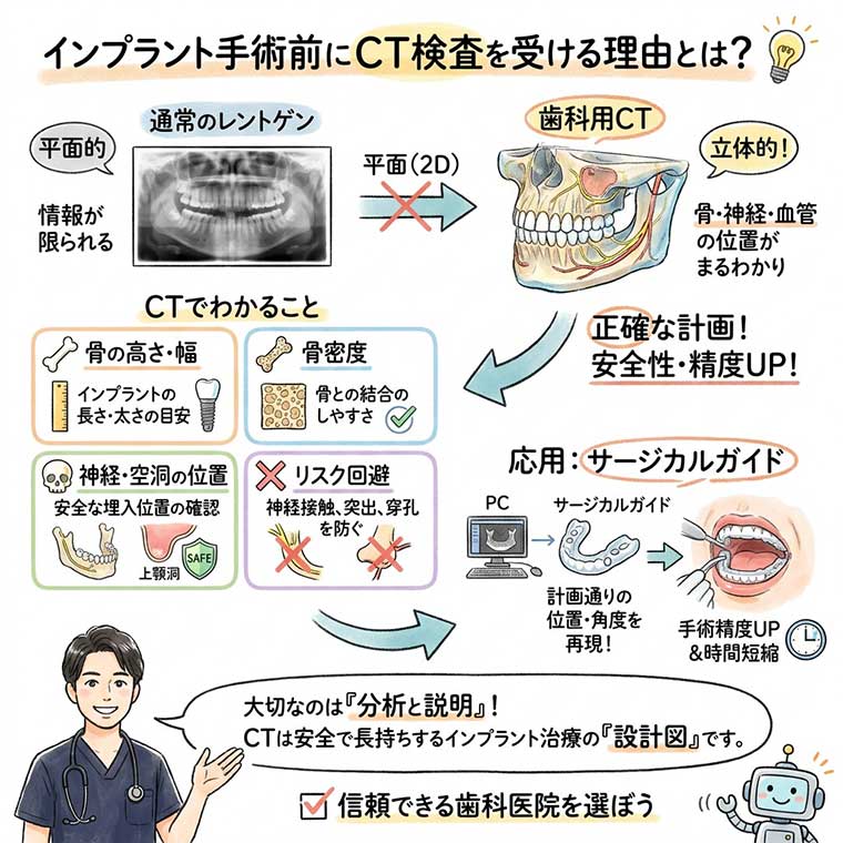 インプラント手術の前後で知っておきたい基礎知識｜CT検査・痛み・腫れ