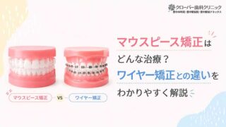 マウスピース矯正はどんな治療？ワイヤー矯正との違いをわかりやすく解説