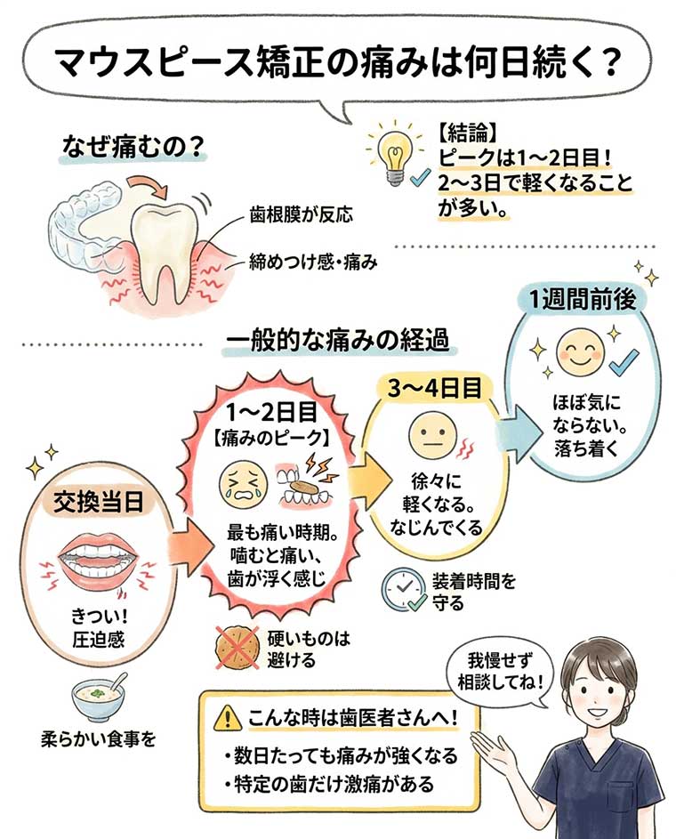 マウスピース矯正の痛みは何日続く？の図解