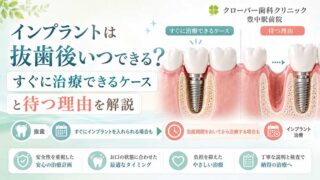 インプラントは抜歯後いつできる？すぐに治療できるケースと待つ理由を解説