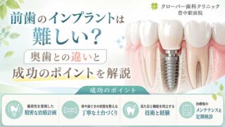 前歯のインプラントは難しい？奥歯との違いと成功のポイントを解説