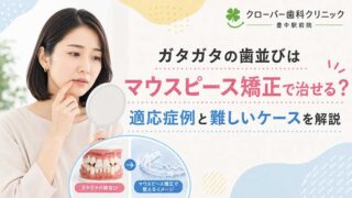 ガタガタの歯並びはマウスピース矯正で治せる？適応症例と難しいケースを解説