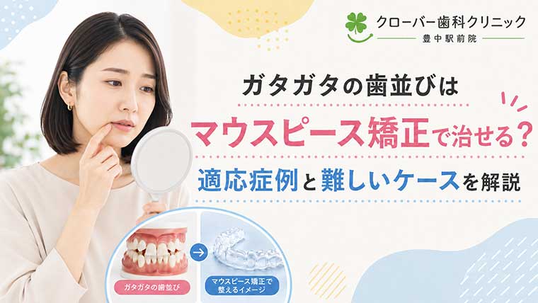 ガタガタの歯並びはマウスピース矯正で治せる？適応症例と難しいケースを解説