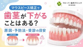 マウスピース矯正で歯茎が下がることはある？原因・予防法・受診の目安