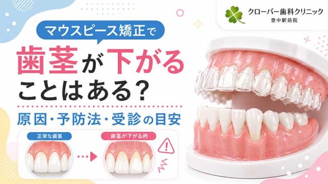 マウスピース矯正で歯茎が下がることはある？原因・予防法・受診の目安